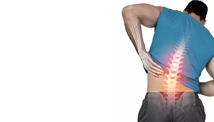 Sciatica Pain: Who can be affected